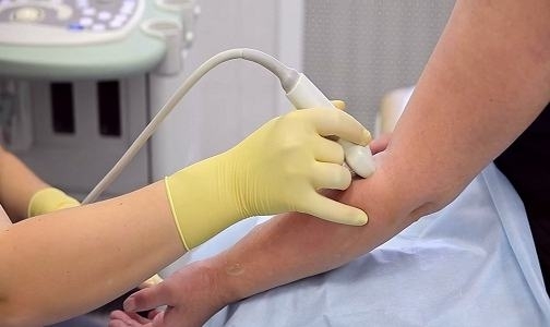 Лимфатический отек руки после мастэктомии
