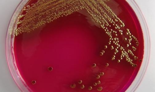 В Европе зафиксированы новые случаи заражения E.coli