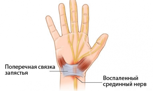 Какие болезни провоцируют планшетные компьютеры