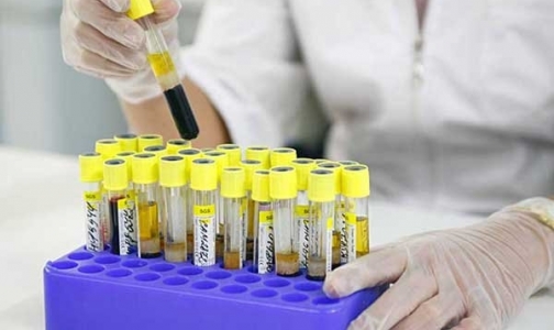 Новые правила оплаты счетов за анализы могут поссорить страховщиков и врачей Петербурга