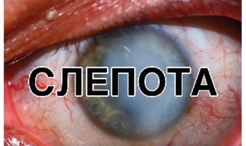 Минздрав «выдал» курильщикам новую порцию «страшилок»