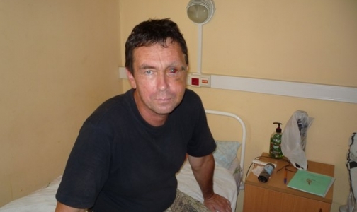 Сотруднику «Скорой» проломили череп, но в полиции не нашли состава преступления