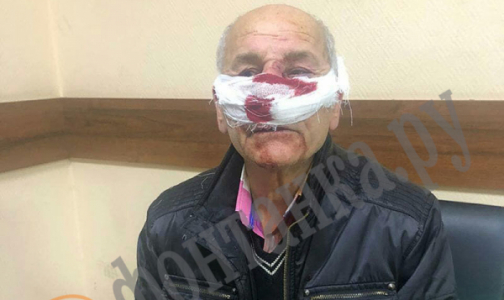 Врач и пациент подрались в машине скорой помощи. Врач на больничном