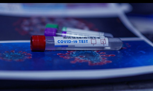  Суточное число инфицированных COVID-19 в Петербурге вновь выросло