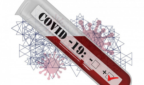 Петербург вновь лидер по суточной смертности от COVID-19. Заболевших почти столько же, что и вчера
