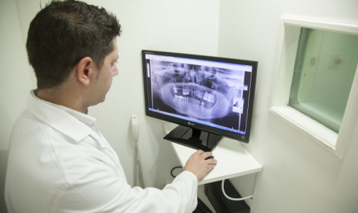 Российские врачи восстанавливают пораженную раком челюсть с помощью 3D принтера и собственной кости пациента
